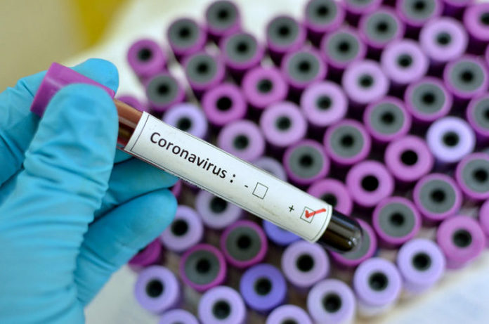 Coronavirus: 148 nouvelles contaminations, 05 décès en 24h